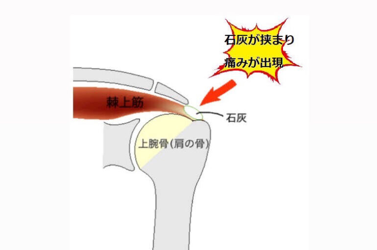 CA9CD9A7-C67A-4FE8-B52F-6E5FE7CDB83B