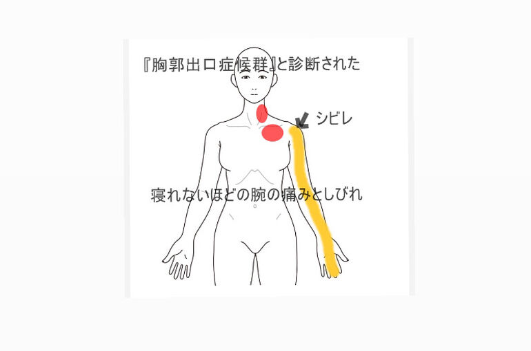 87CE7961-D7C0-4228-B8F0-F32A27C8A76C