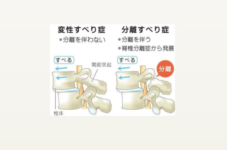 30A2EB9D-E5EC-4DB9-B58D-D74EF46DD3A5