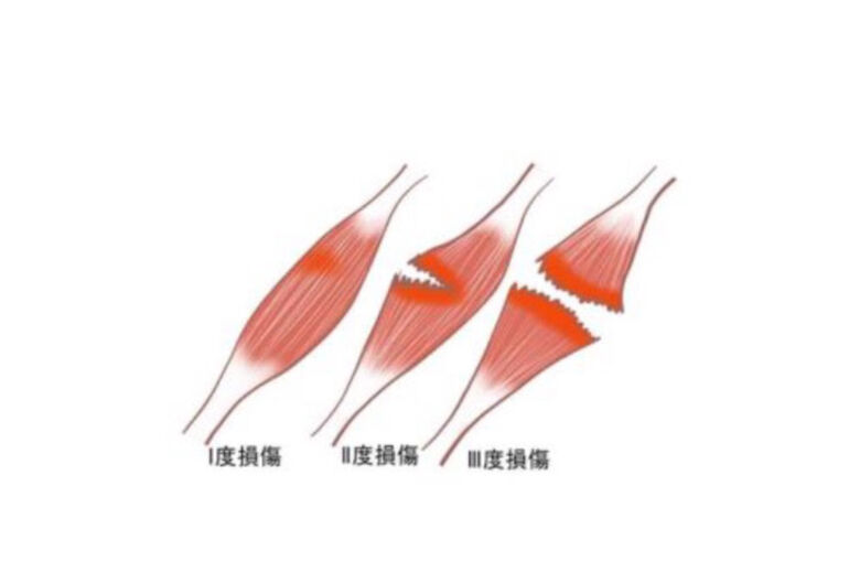 BD641F97-FF99-49A3-8487-4E1E7504C08E